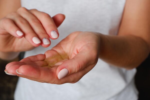 Alergia la gel: cum recunoști reacția la acrilați și ce faci mai departe